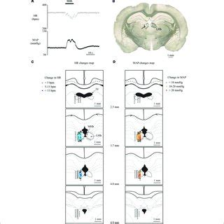 A C E Changes In Heart Rate HR And Mean Arterial Pressure MAP