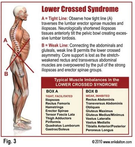 Pin On Psoas Pain