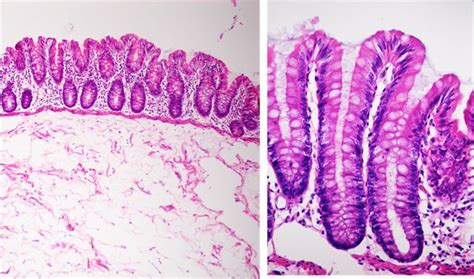 Sos Biologia Celular Y Tisular Digestivo Histology Of The Digestive