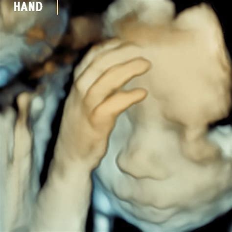 4d Hd Ultrasound Pregnancy Scan Fatima Gani