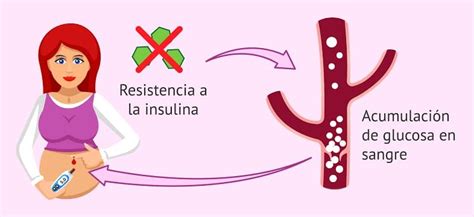 Resistencia A La Insulina Que Es Síntomas Y Tratamiento 55 Off