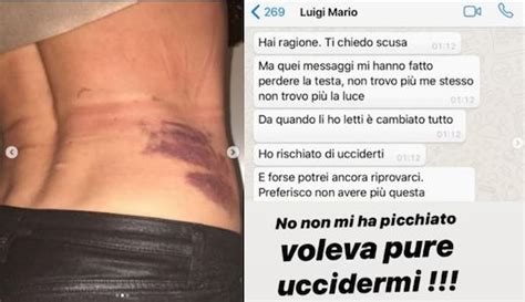 Nina Moric Mostra I Lividi E Pubblica I Messaggi Di Luigi Favoloso