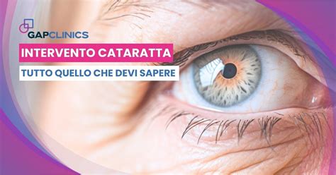 Intervento Cataratta