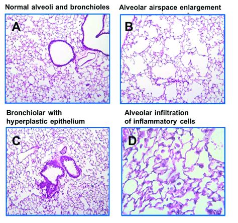 Histopathologic Examination Of Lung Tissues Of Bco1 − − Bco2 − − Dko