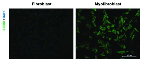 Fibroblast To Myofibroblast Transition Primary Cells Were Stained With