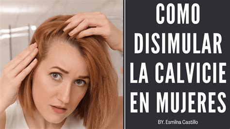 Como Disimular La Calvicie En Mujeres 5 Tips Esmilna Castillo