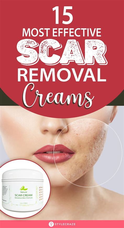 Best Scar Removal Creams Of Reviews Buying Guide Scar