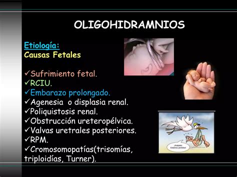 Polihidramnios Oligohidramnios Cynthia Supo Salas Ppt