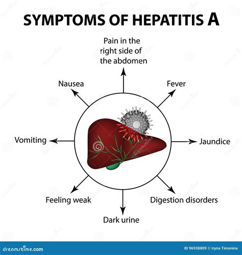 Symptoms Of Hepatitis A Liver Virus Infographics Vector