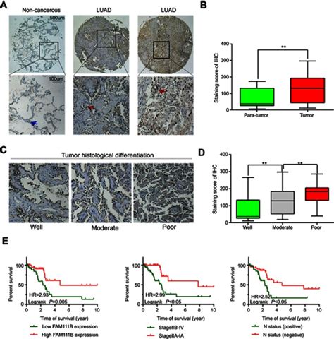 Fam B A Direct Target Of P Promotes The Malignant Process Of Lung