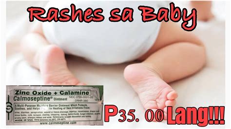 Gamot Sa Rashes Ni Baby Youtube