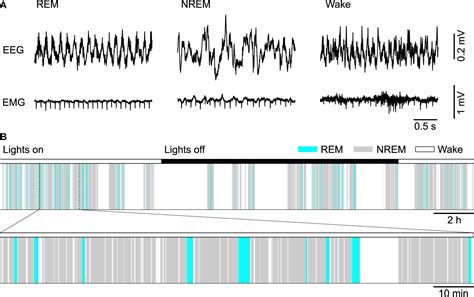 Frontiers Neural And Homeostatic Regulation Of Rem Sleep