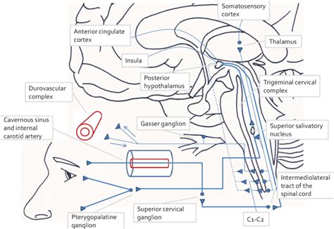 Diagram Summarising The Pathophysiology Of Cluster Headache Ch And