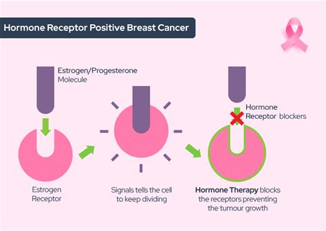 Demystifying Breast Cancer and its Treatment | Aeon Care