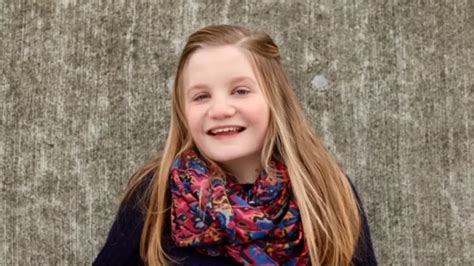 Turner Syndrome 23 Important Symptoms Cause Short Stature