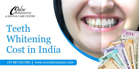 Teeth Whitening Cost In India How Long Does Teeth Whitening Last