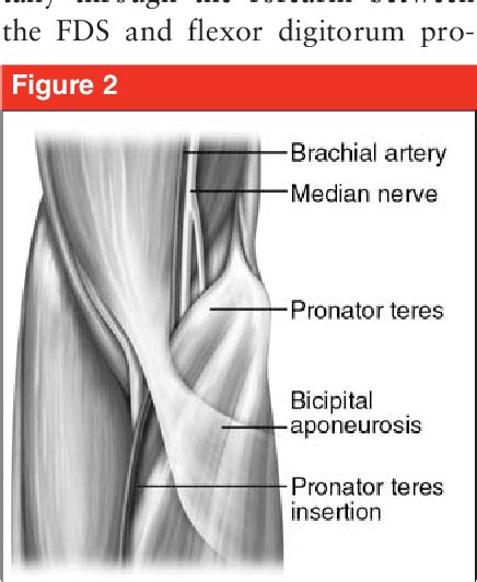 Figure 1 From Pronator Syndrome And Anterior Interosseous Nerve Syndrome Semantic Scholar