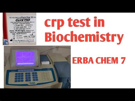 Crp Test In Biochemistry Machine Erba Chem 7 Fully Automatic