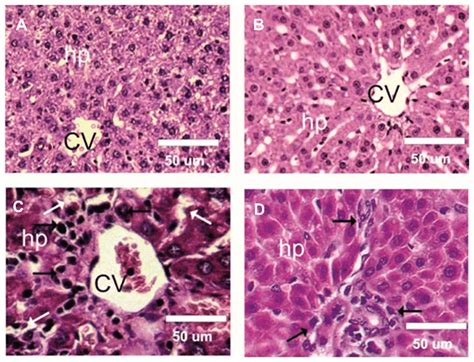 Photomicrographs Of Rat Liver Sections Of Different Experimental Groups