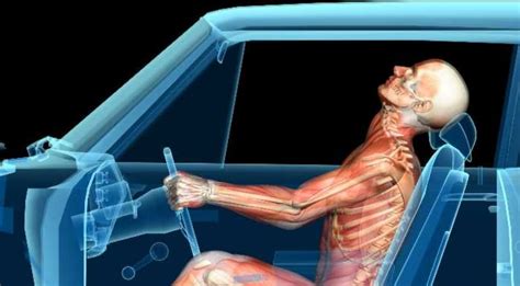 Whiplash ITC Vertebral