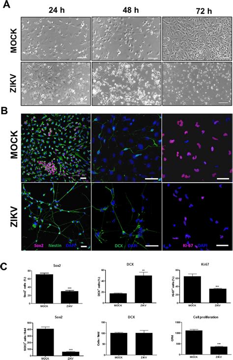 Human Ipsc Derived Npc Are Highly Sensitive To Zikv Infection A Npc