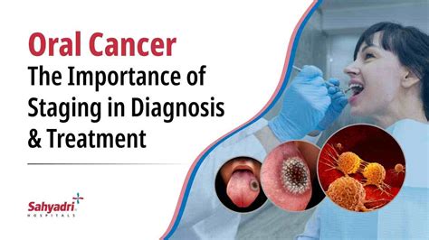 Oral Cancer Stages Symptoms And Treatment Options