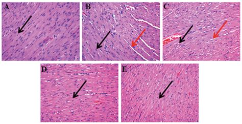 SciELO Brasil Protective Effect Of Combined Metoprolol And