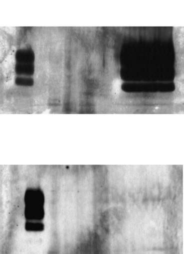 Detection Of Prp Sc In Lymphoid Tissues A And Lymph Nodes B In Case