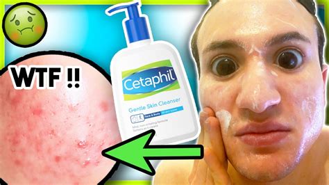 I Tried Cetaphil Gentle Skin Cleanser For One Week It Broke Me Out Youtube