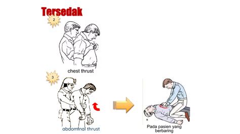 Pertolongan Pertama Gawat Darurat PPT