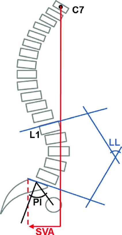 Sagittal Pelvic Parameters Measured On The Standing Lateral Radiograph