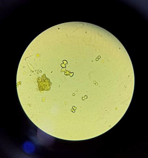 Examen microscópico del sedimento urinario LABORATORIO VETERINARIO