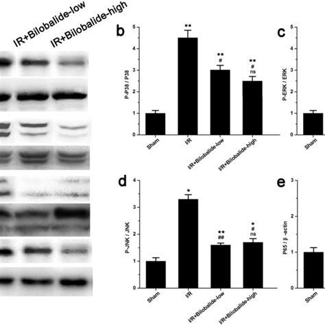 Bilobalide Relieved The Skeletal Muscle Inflammatory Response Post I R