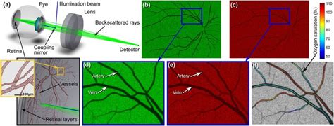 Simulation of retinal imaging and vasculature contrast in a SLO. The ...