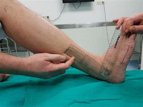 Ankle Goniometer Measurements