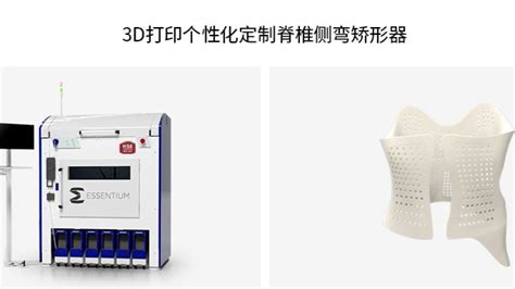 【3d打印服务】3d打印脊椎侧弯矫形器流程分享 哔哩哔哩