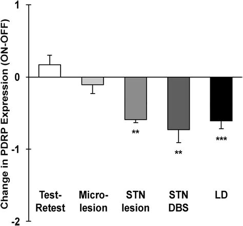 Metabolic Imaging In Parkinson Disease Journal Of Nuclear Medicine