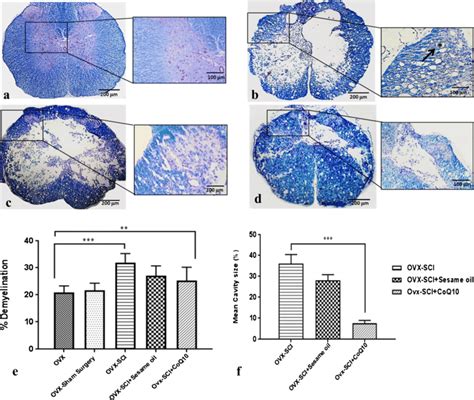 Luxol Fast Blue Staining That Was Used For Rate Of Demyelination Showed