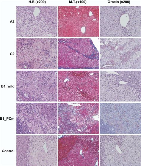 Immunohistochemical Analysis Of Liver Tissue Comparison Of Liver Download Scientific Diagram