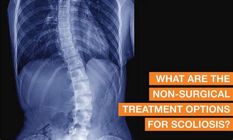 Know Scoliosis Treatment Without Surgery Qi Spine