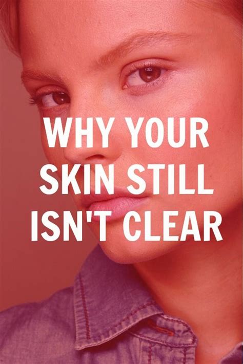 192 Best Clear Skin Images On Pinterest