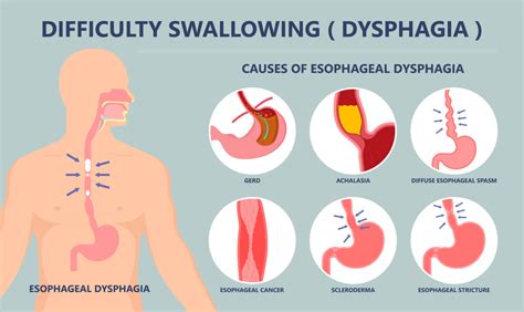 Dysphagia Causes