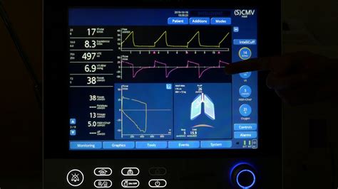 sporco Manifestazione interpretazione hamilton g5 ventilator inodoro ...