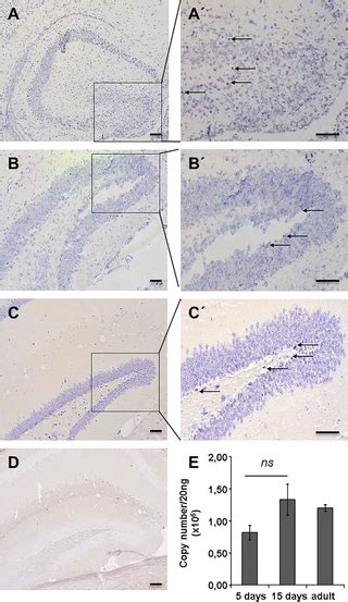 Microrna 451a Overexpression Induces Accelerated Neuronal