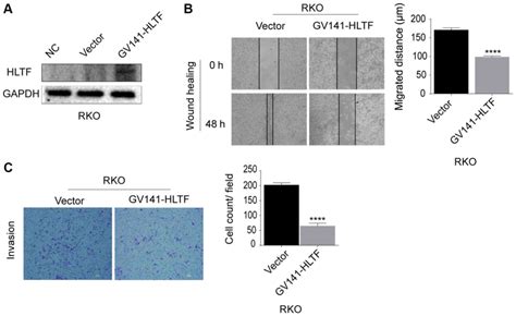 Hltf Suppresses The Migration And Invasion Of Colorectal Cancer Cells