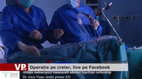 Operație pe creier live pe Facebook YouTube