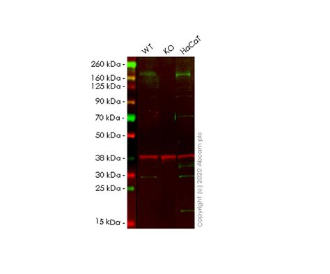 Anti Factor H Antibody EPR6225 BSA And Azide Free Ab248539 Abcam