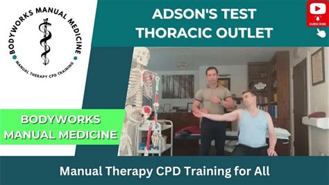 Adson S Test Thoracic Outlet Youtube