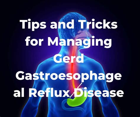 Acid Reflux Sos Tips And Tricks For Managing Gerd