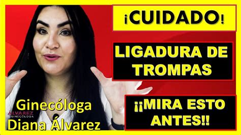 Antes De La Ligadura De Trompas Mira Este Video Ginec Loga Diana